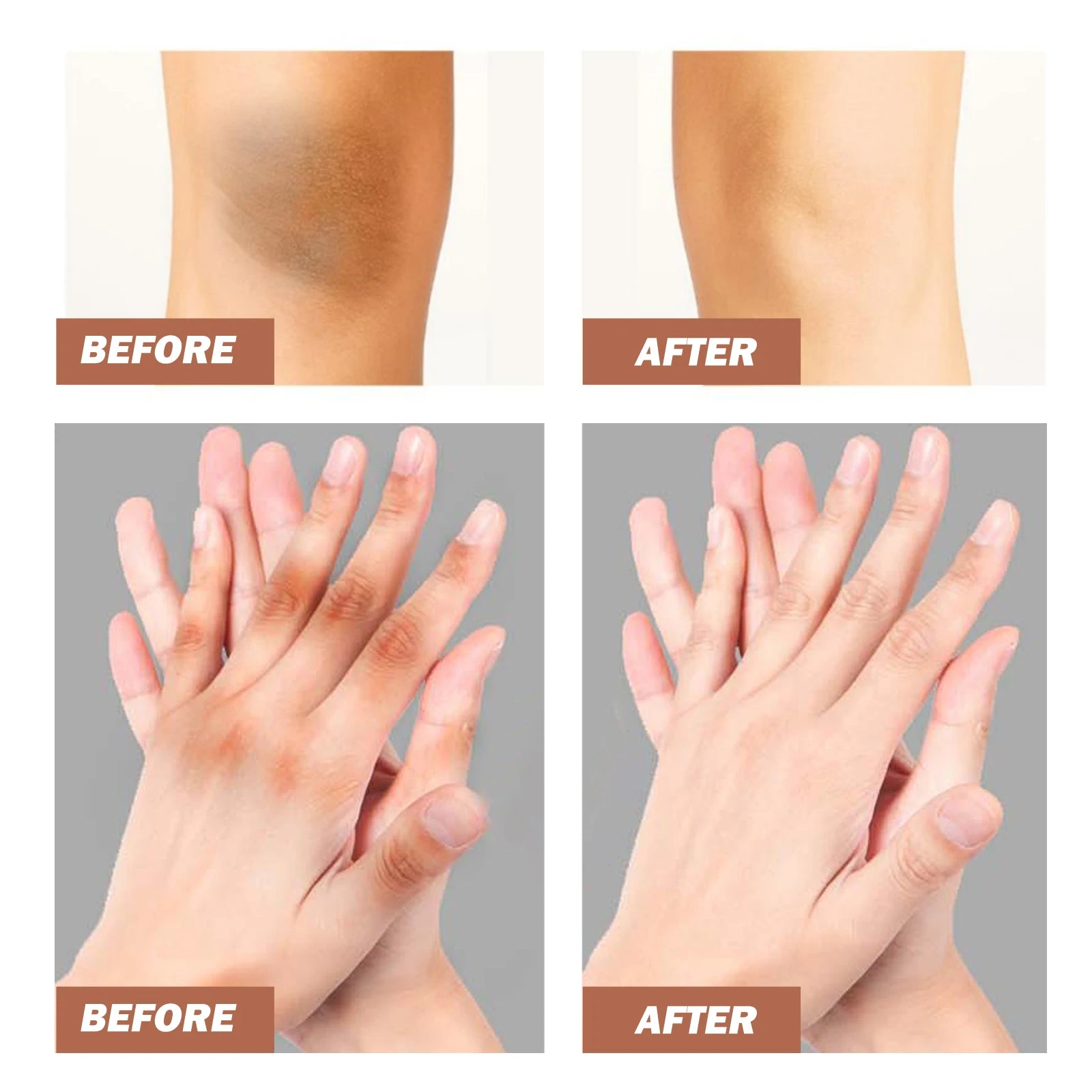 50g Kojic Acid Whitening Cream
