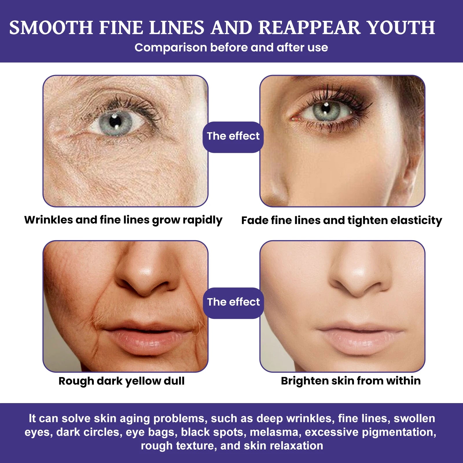 EELHOE Rose Fruit Oil Facial Essence