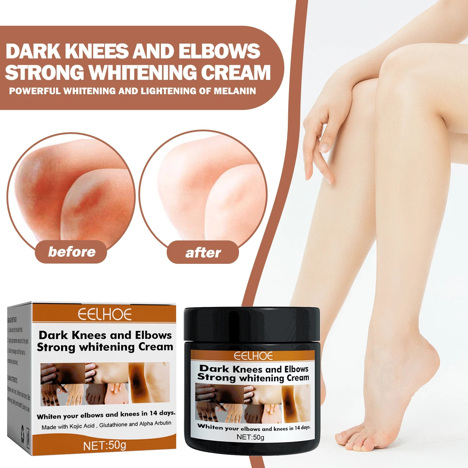 50g Kojic Acid Whitening Cream