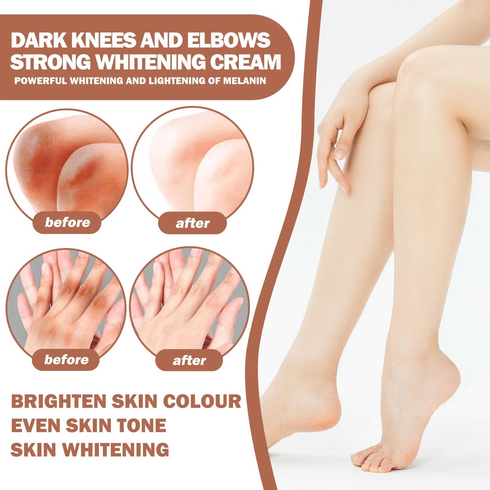 50g Kojic Acid Whitening Cream